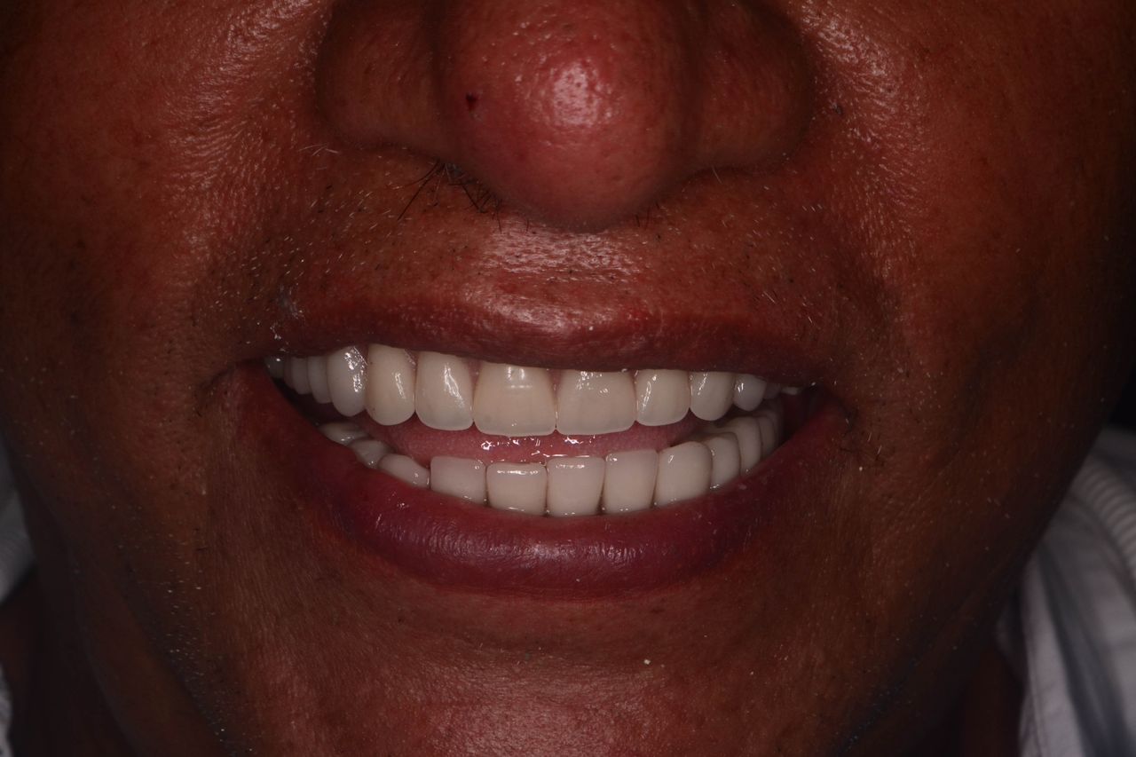 Edith Molina Miranda-6