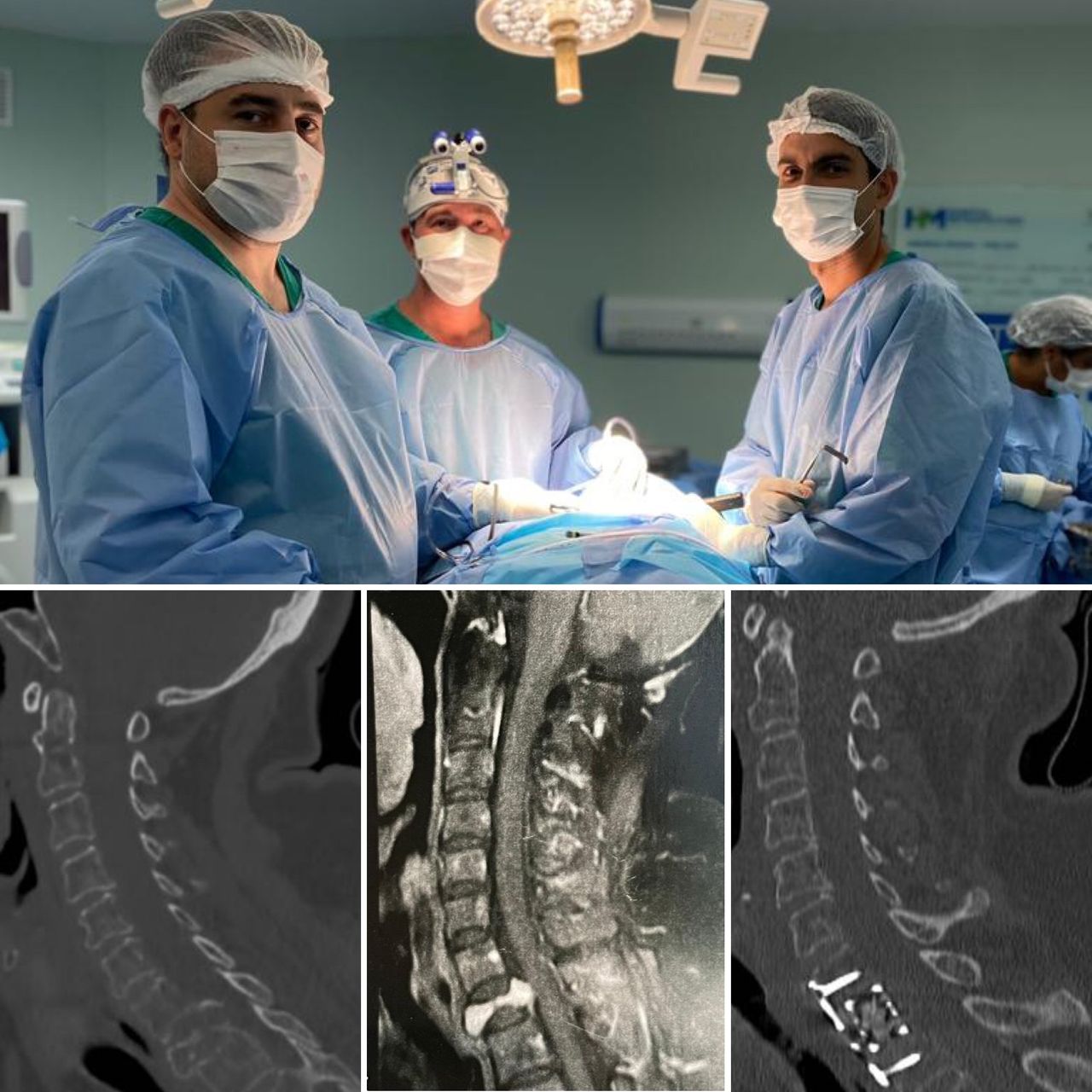 José Lopes Sousa Filho-5