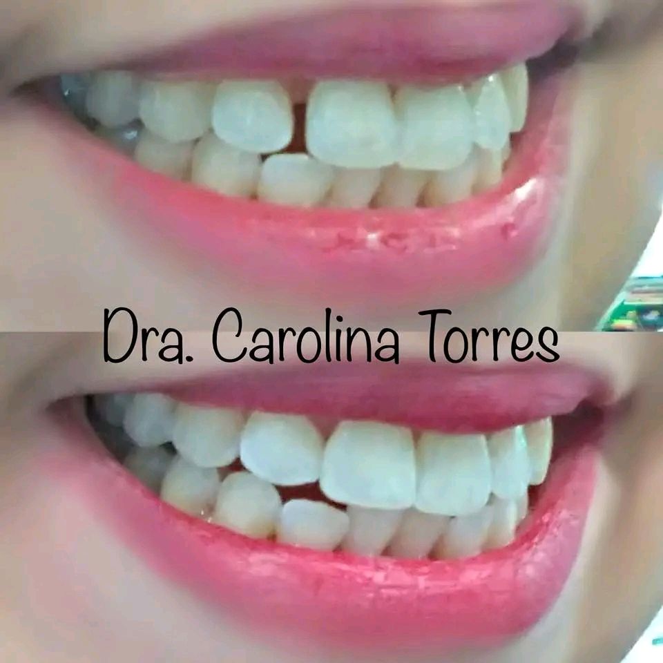 Carolina Alejandra Torres Acuña-0