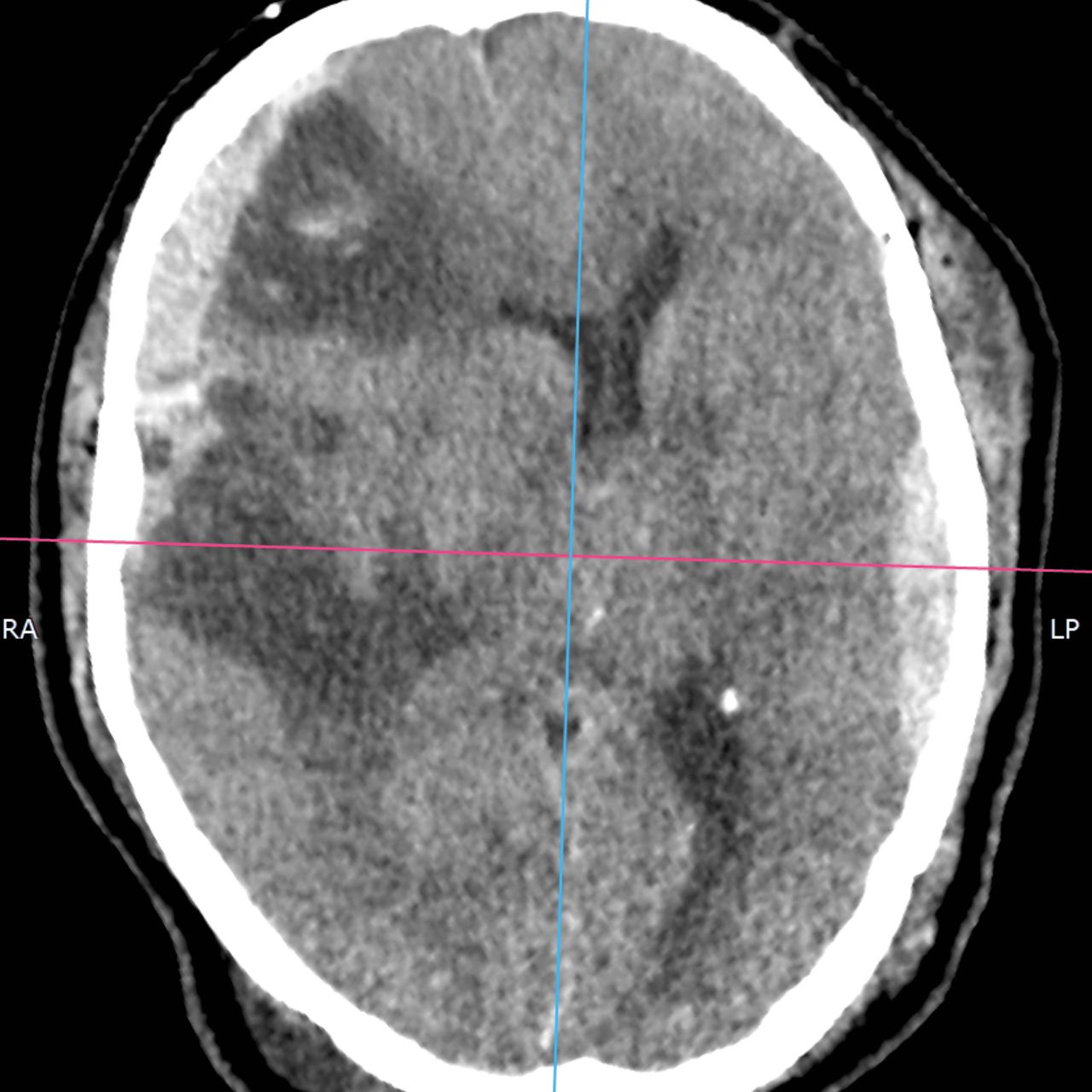 David Tafur Muñoz-2352