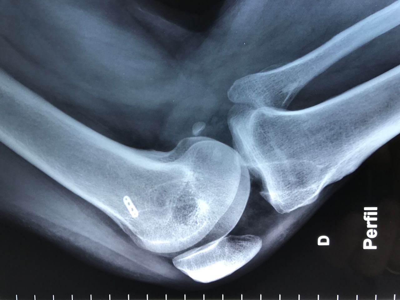 Alexandre Terruggi Jr-7