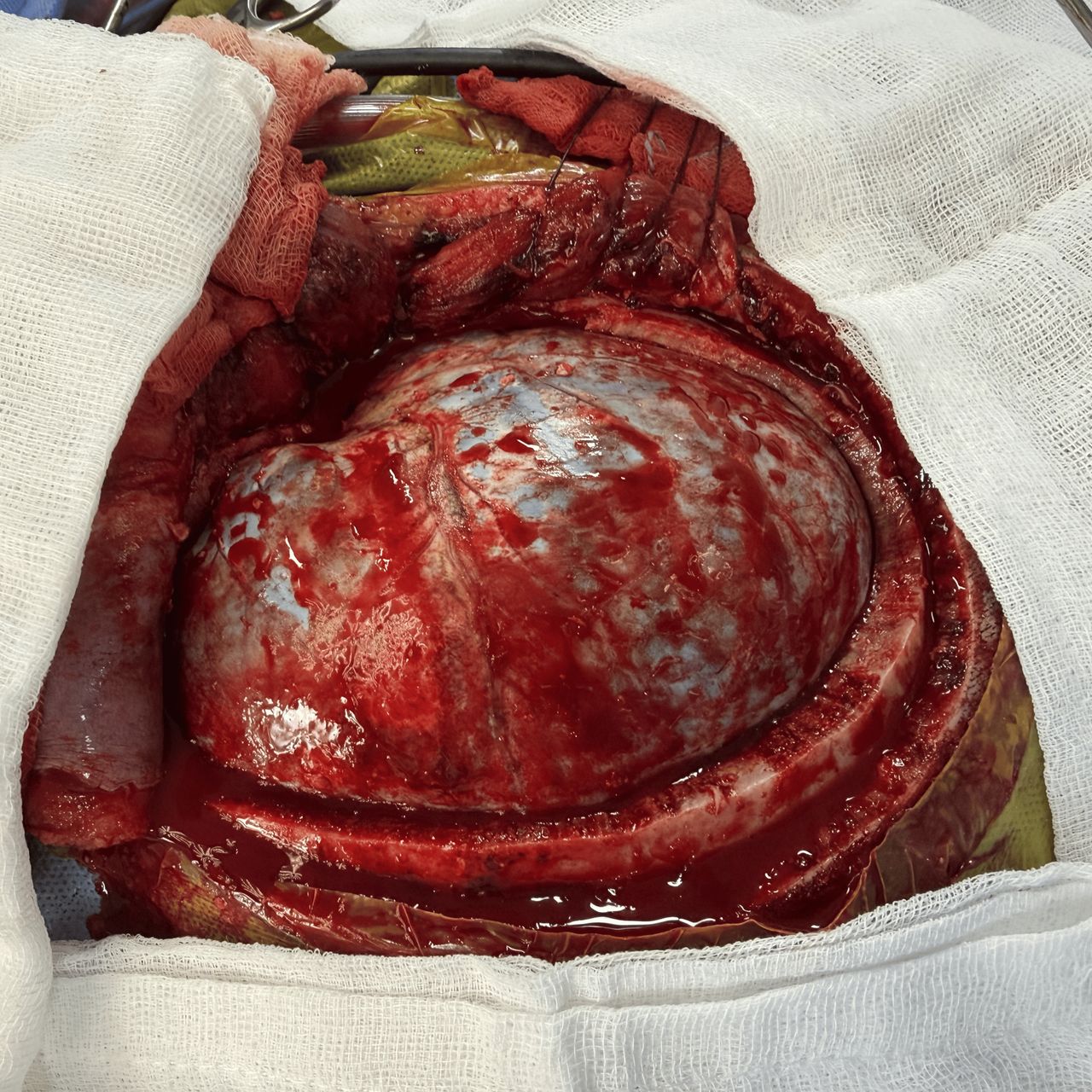 David Tafur Muñoz-2348