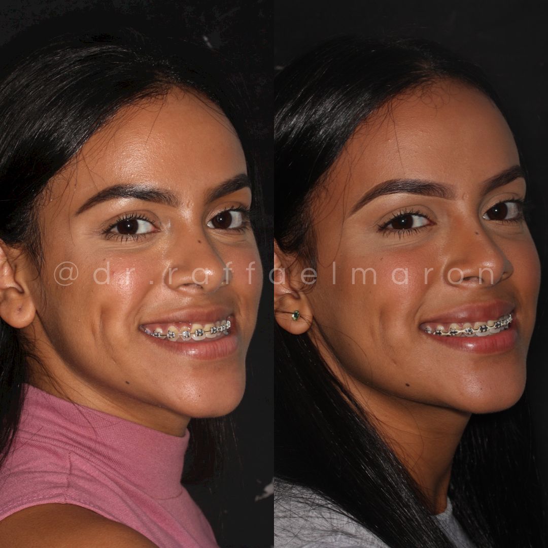 Raffael Maron Vieira De Noronha-4