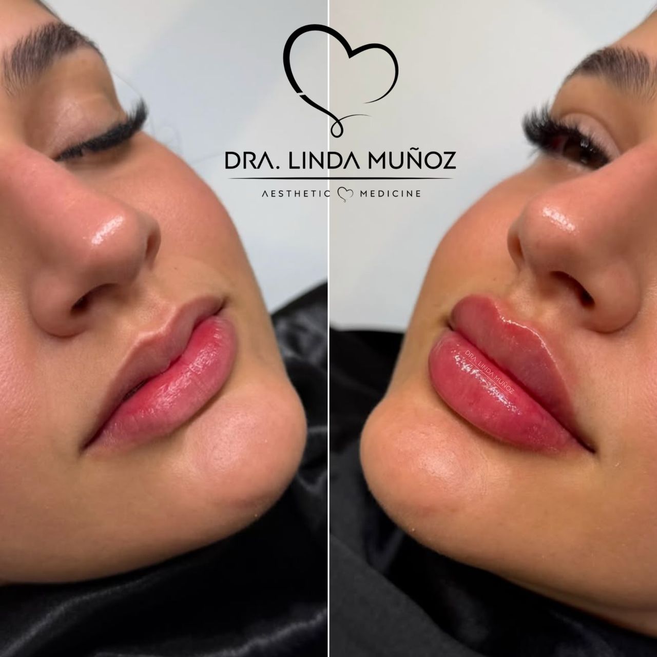 Linda Muñoz-13