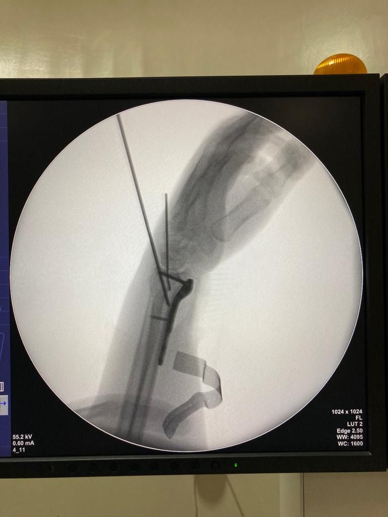 Javier Orlando Montero Gil-3