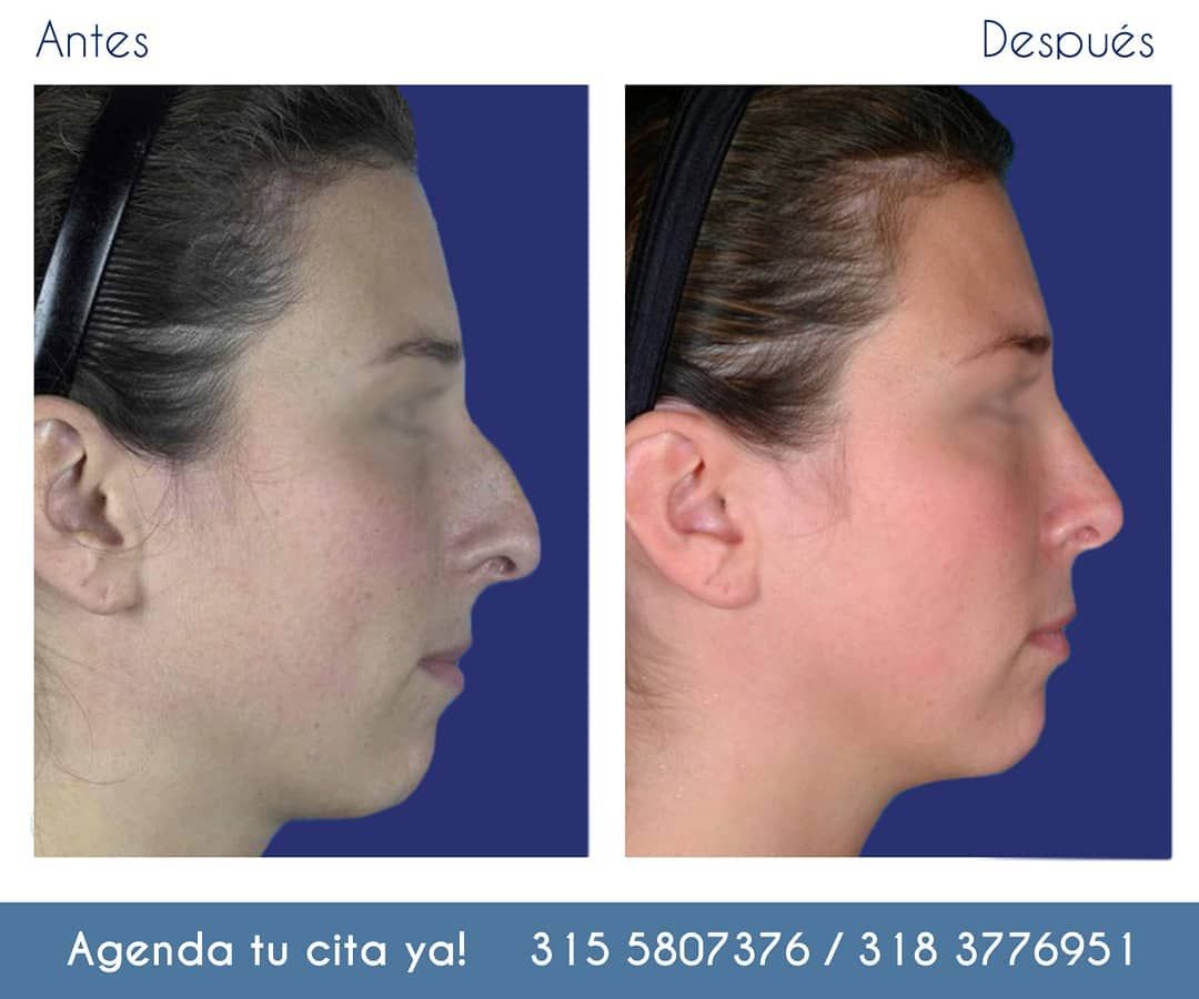 Jorge A Holguin Ruiz-50