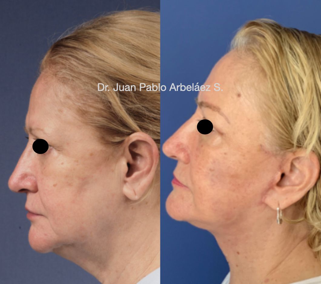 Juan Pablo Arbeláez Sierra-36