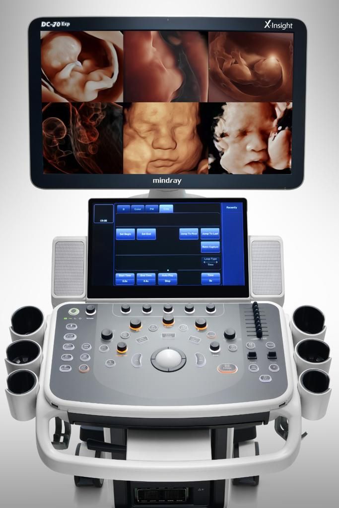 Winston Mendoza Quintana-3