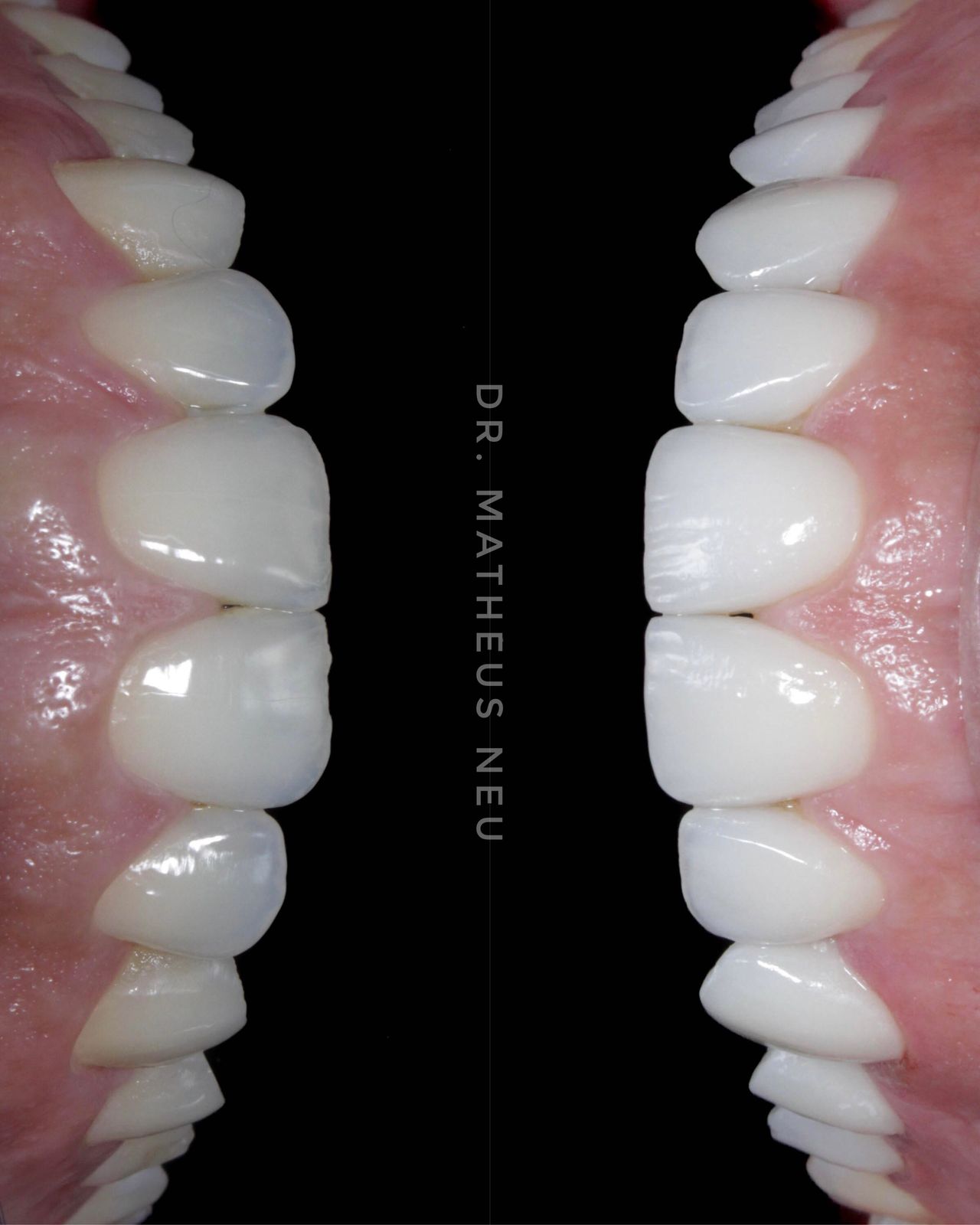 Matheus Da Silveira Neu-13