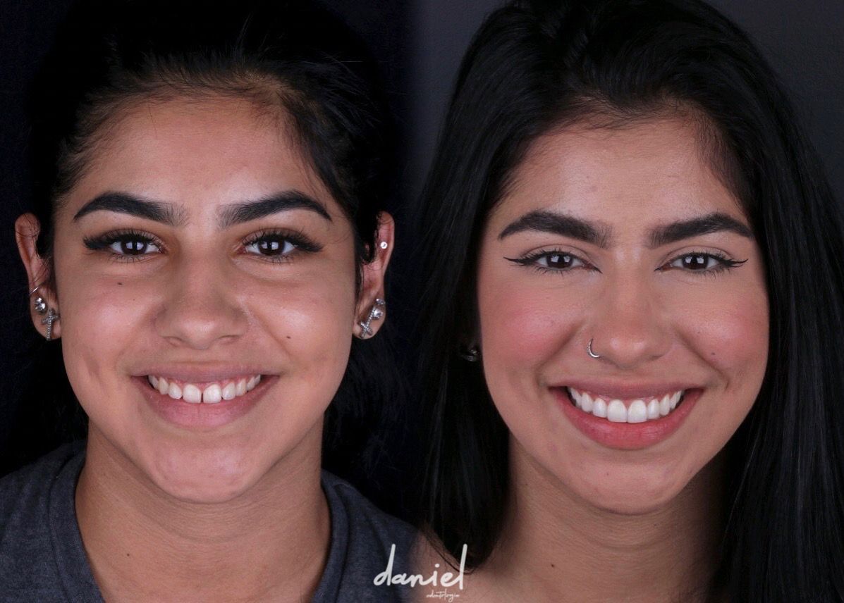 Daniel De Souza Pereira-8