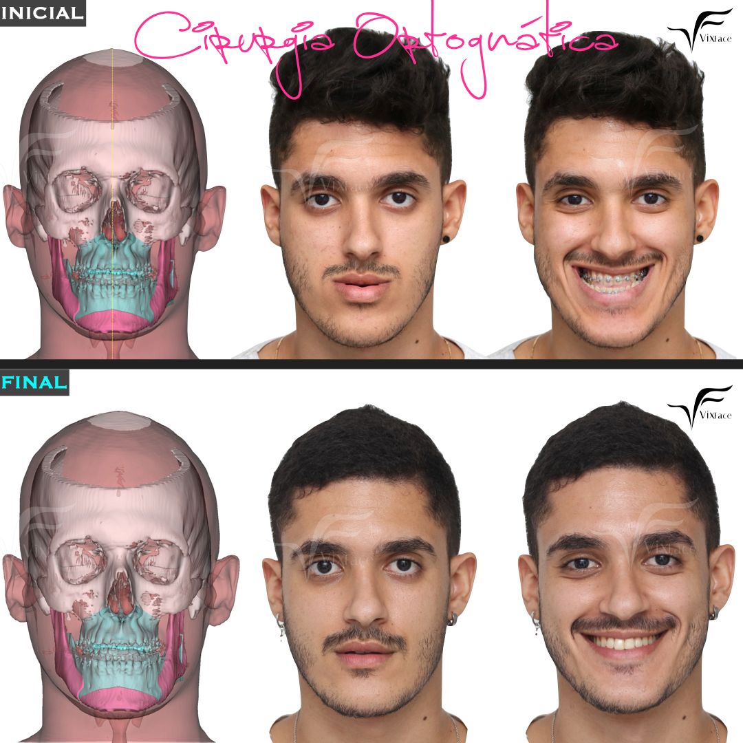 Raphael Coser-9