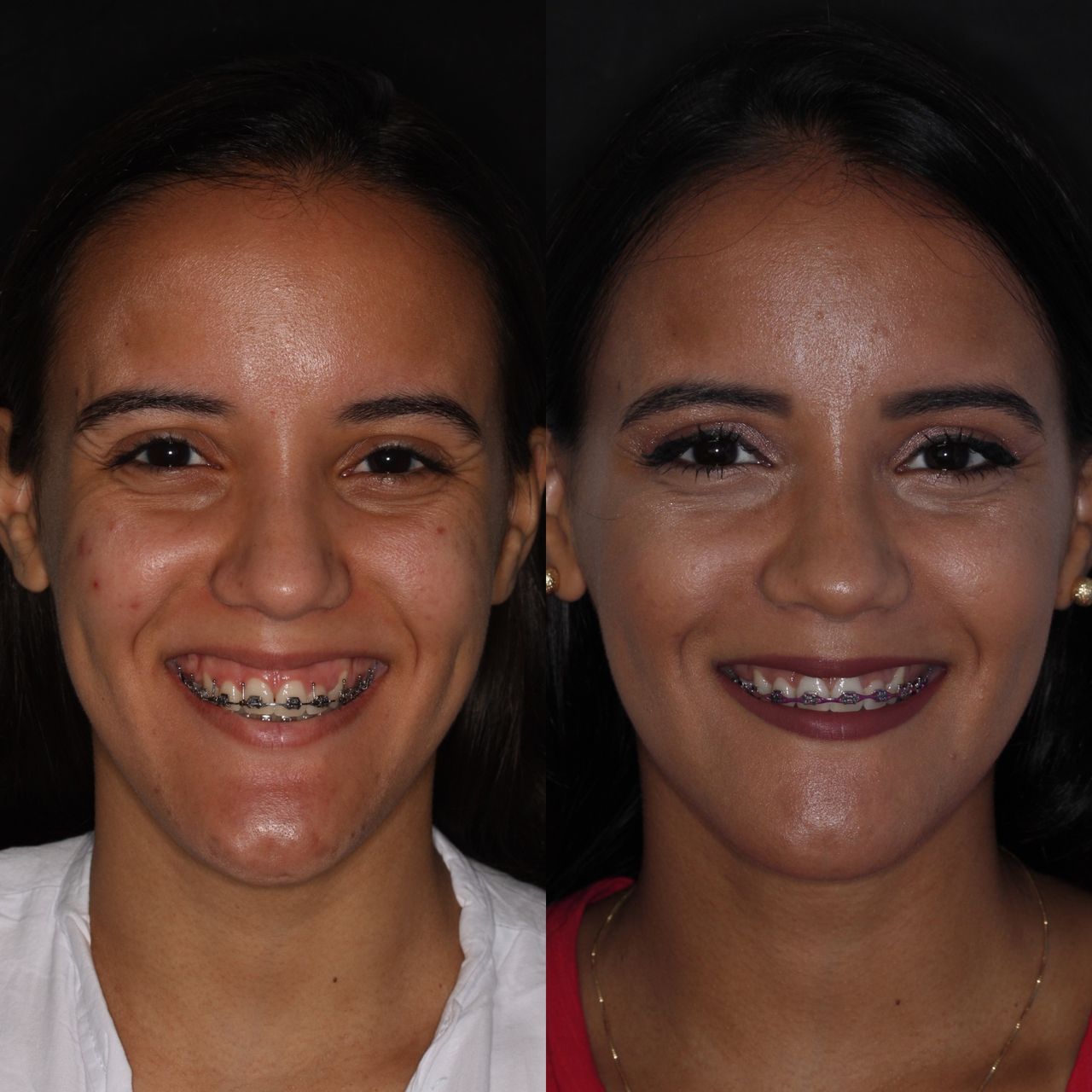 Raffael Maron Vieira De Noronha-27