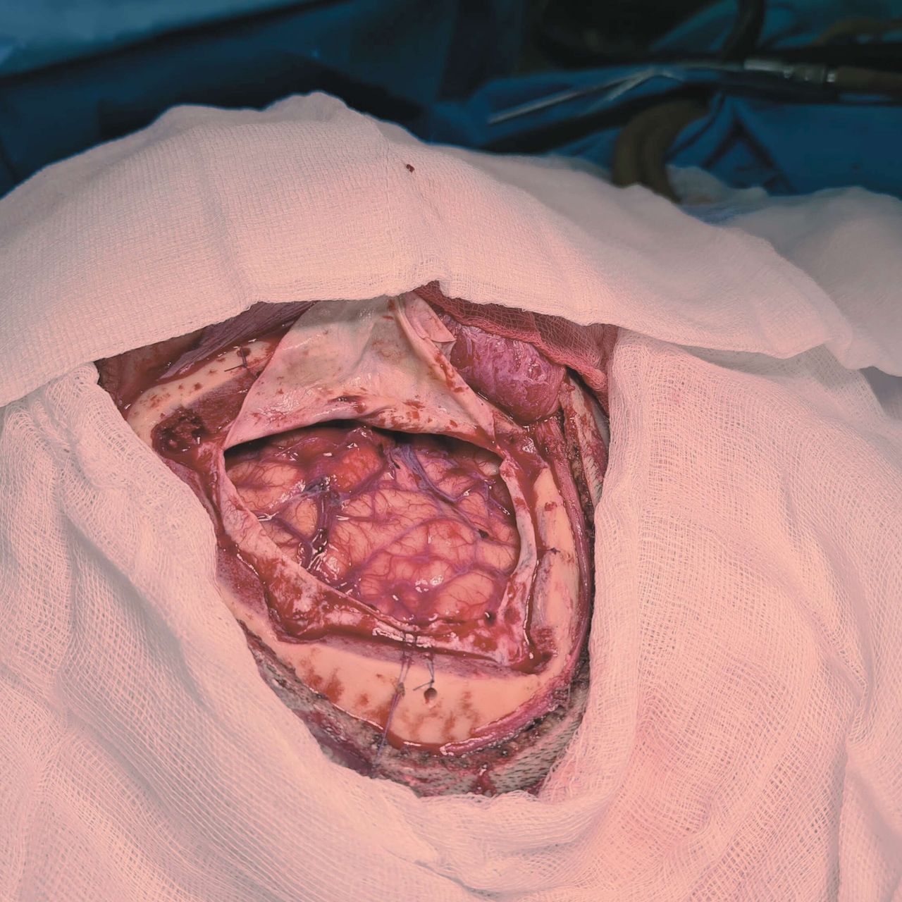 David Tafur Muñoz-3117