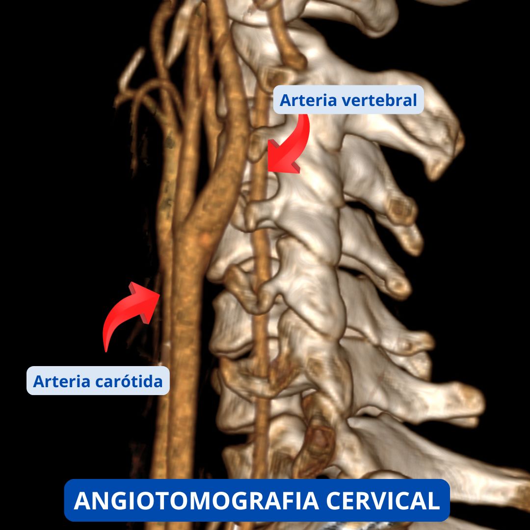 David Tafur Muñoz-2280