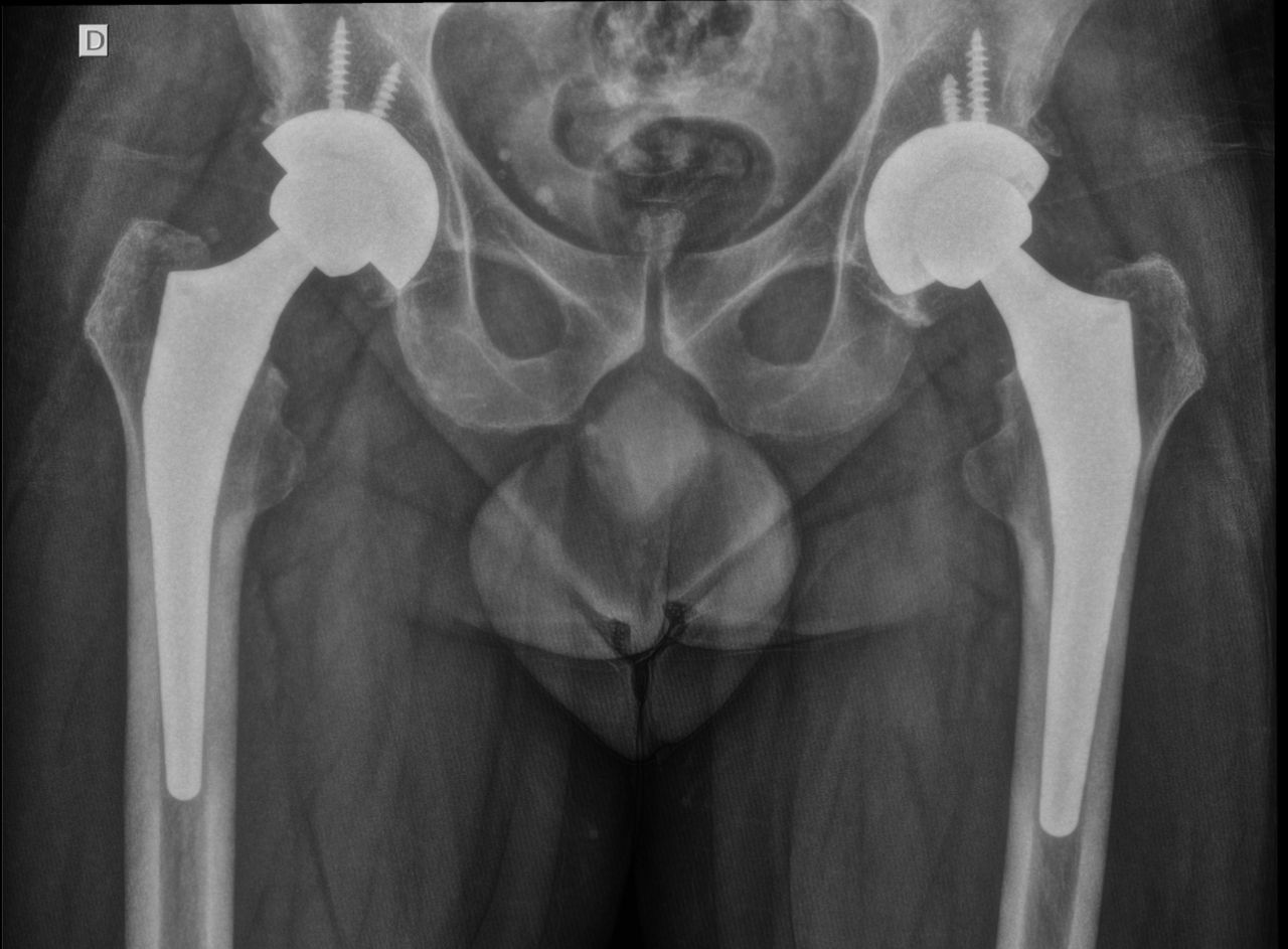 João Mauro Mendina De Morais-4