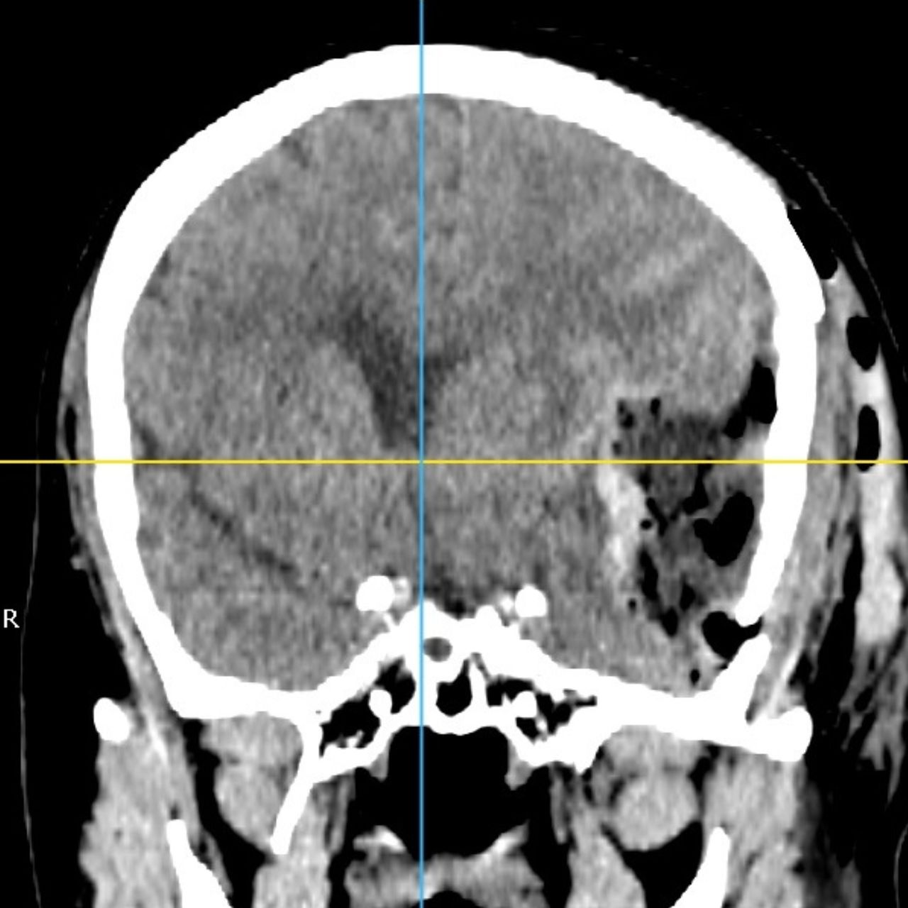 David Tafur Muñoz-1477