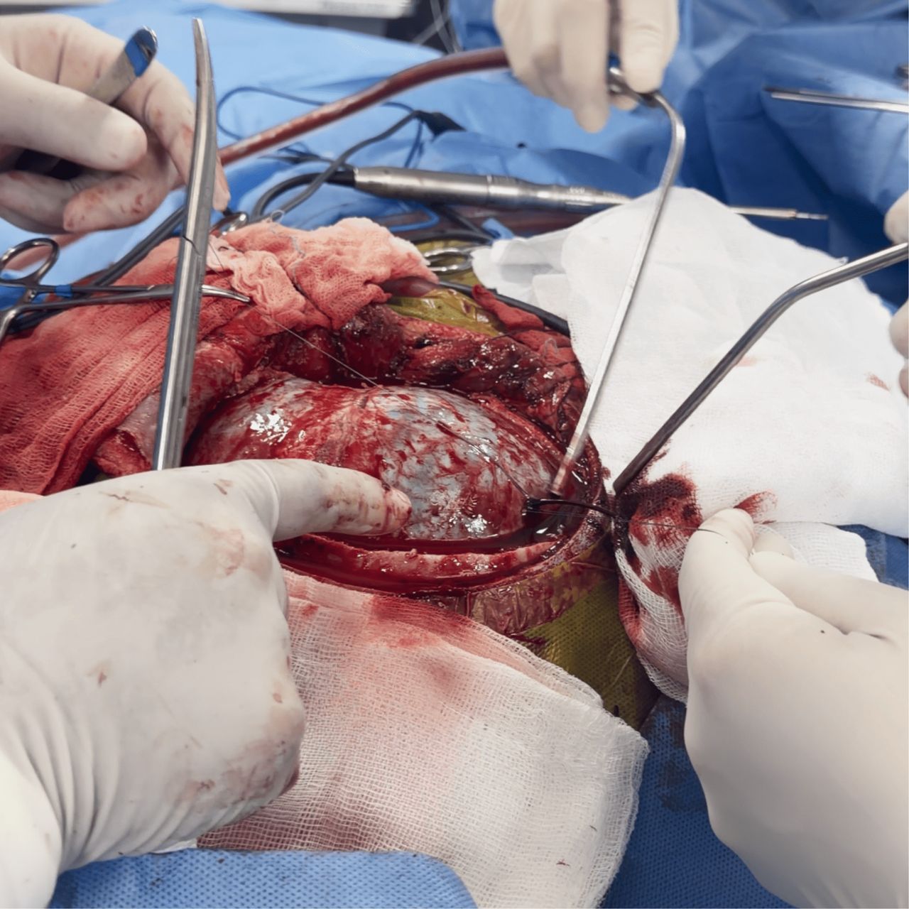 David Tafur Muñoz-2347