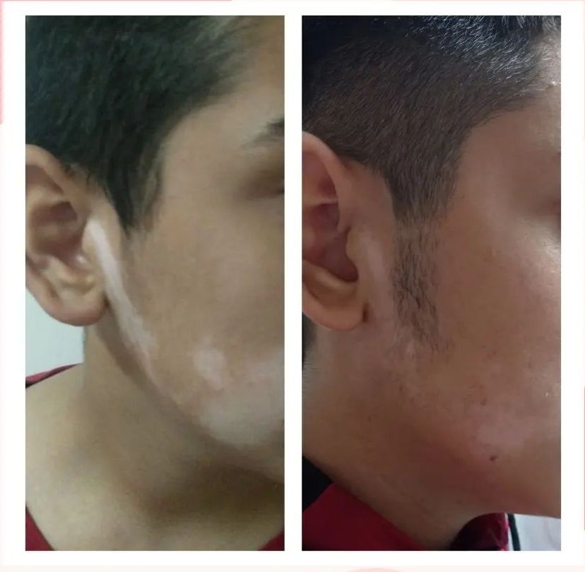 Fernando Vasquez Maldonado-6