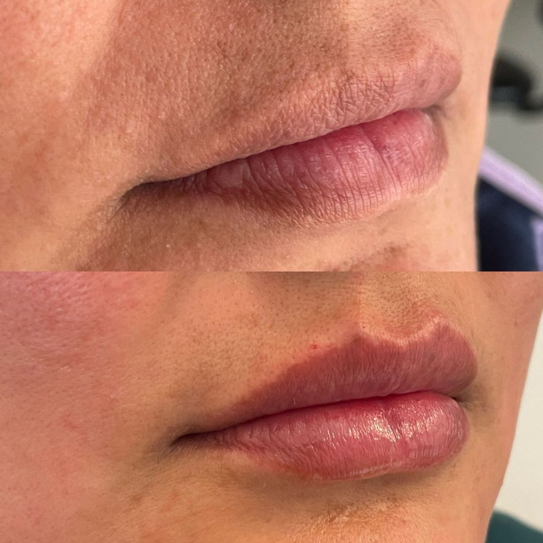 Scarlett Bartsch Ferrada-35