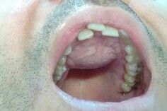 Alexandre Giannini-15