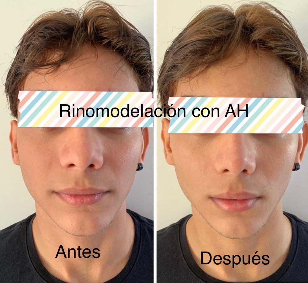 Maria Gisela Angel Losada-43