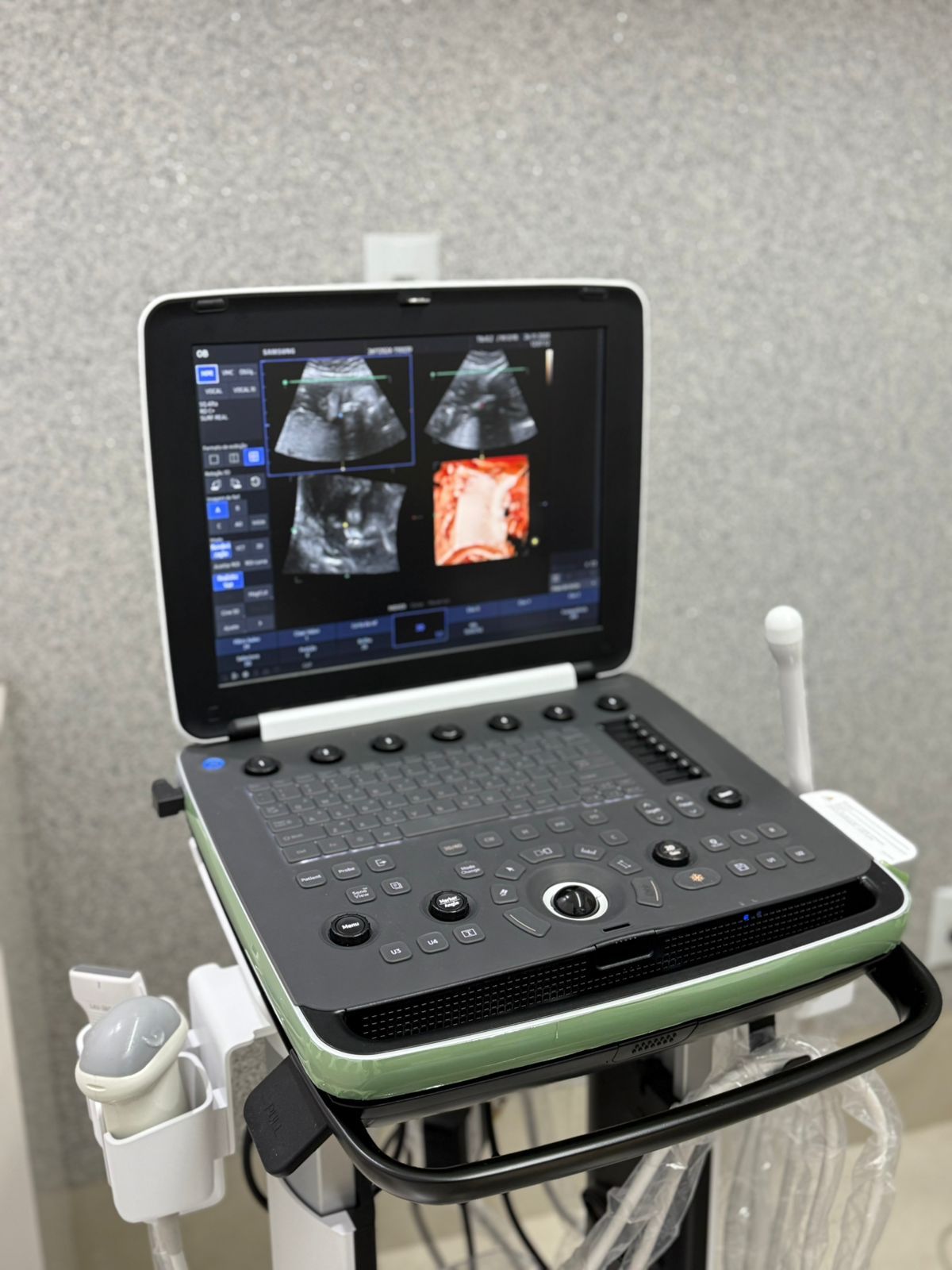 Antonio  Carlos Da Silva Junior-0