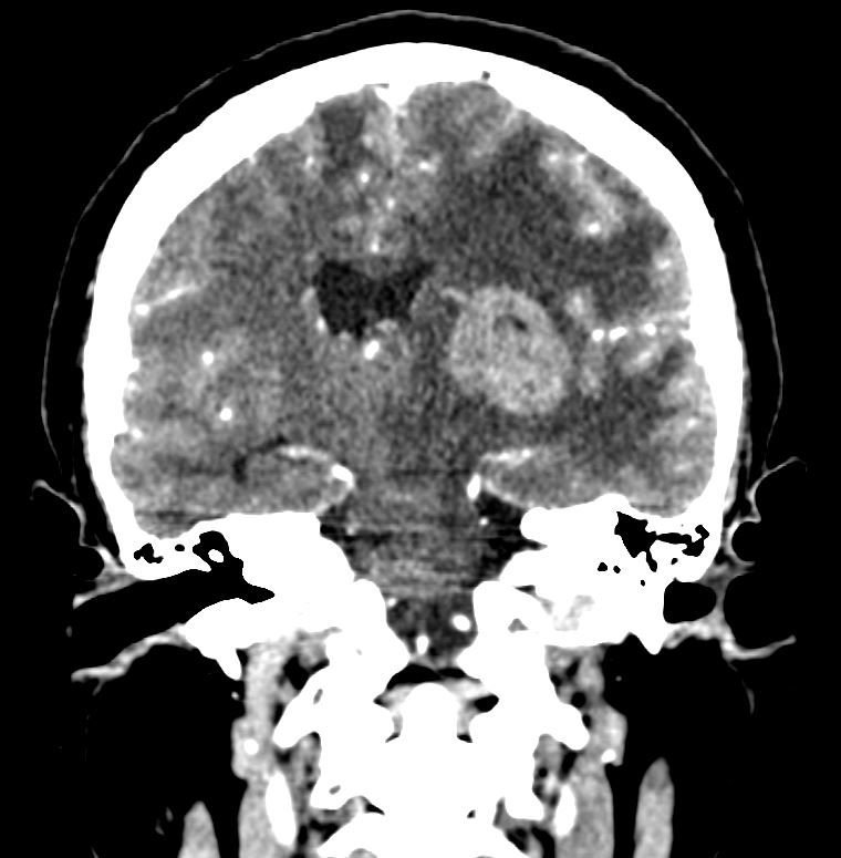 David Tafur Muñoz-1073