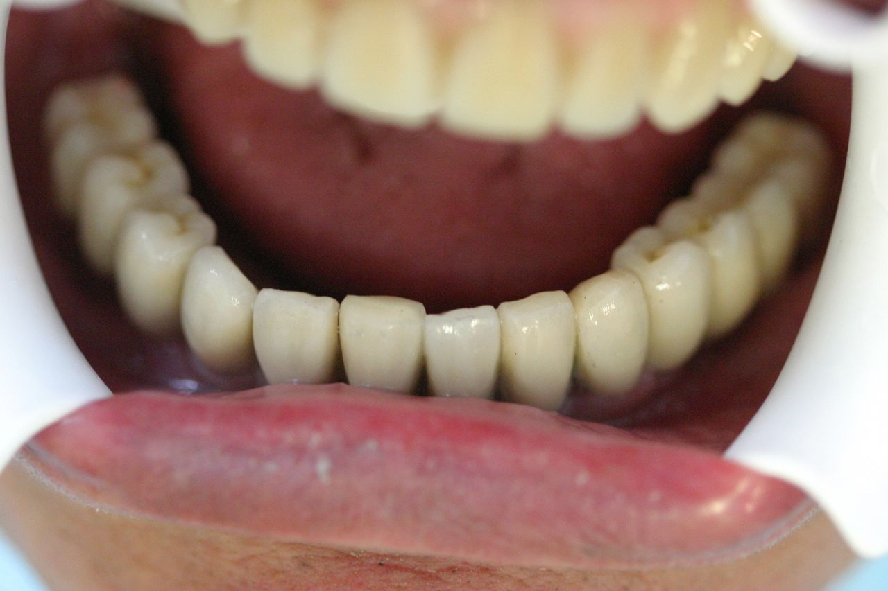 Isail Klahr Averbuch-6