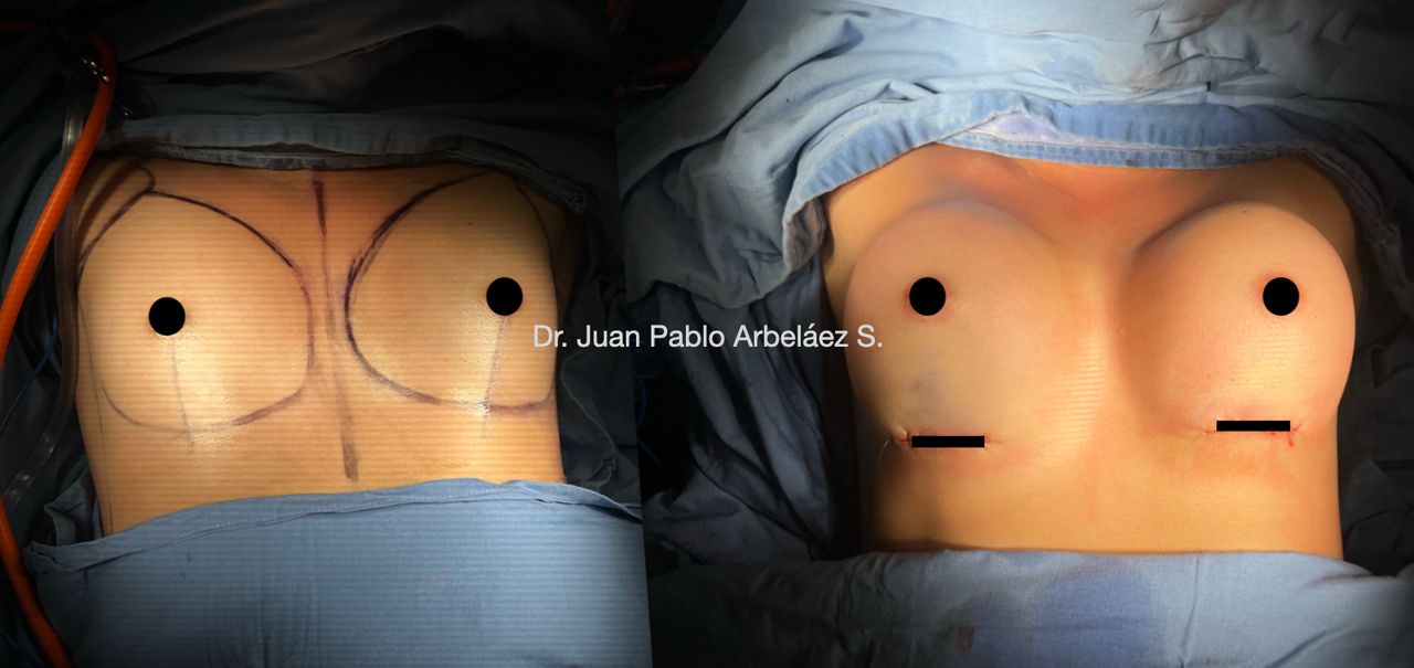 Juan Pablo Arbeláez Sierra-47