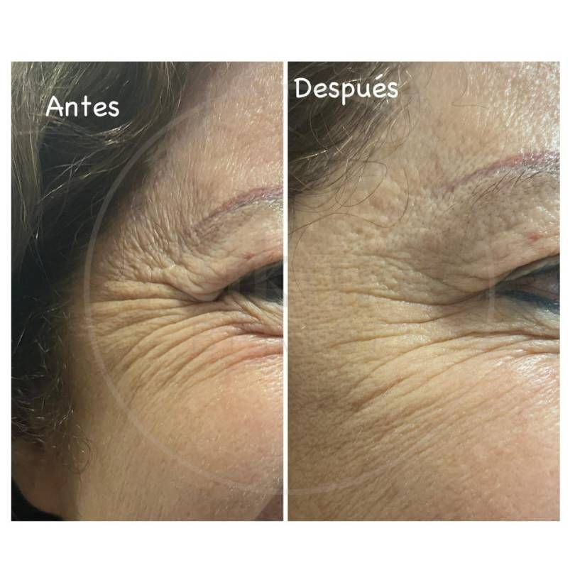 Oscar Iván Lozano Navarrete-22