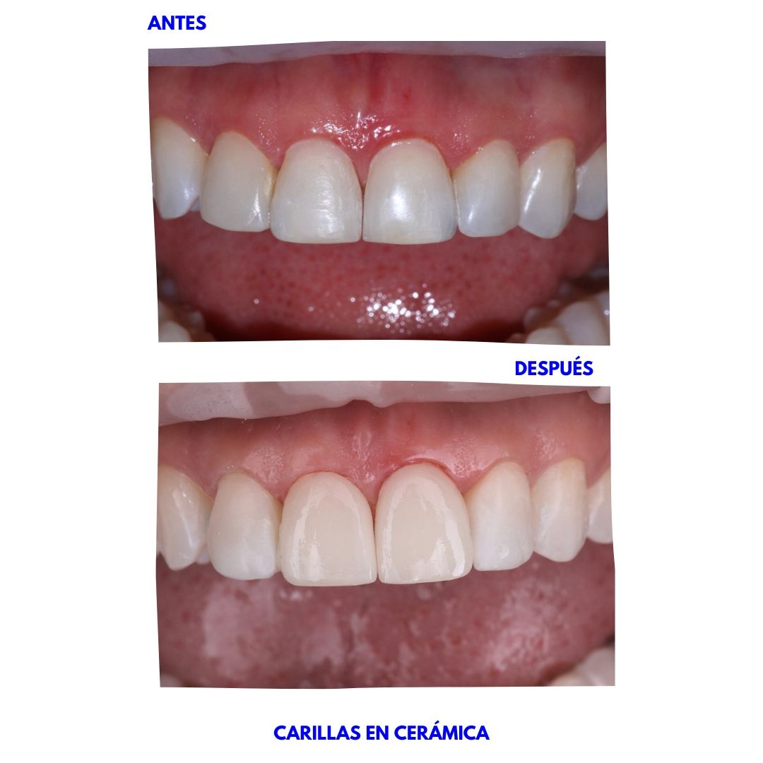 Carlos Andrés Giraldo Muñetón-4