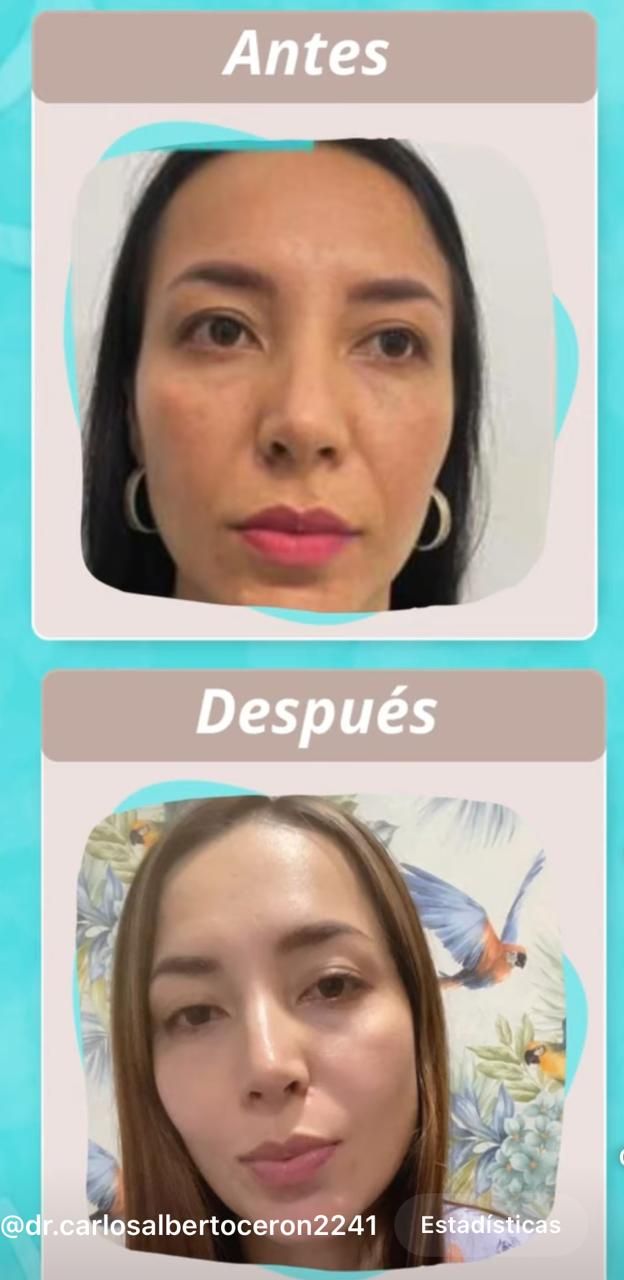 Carlos Alberto Ceron Gomez-3