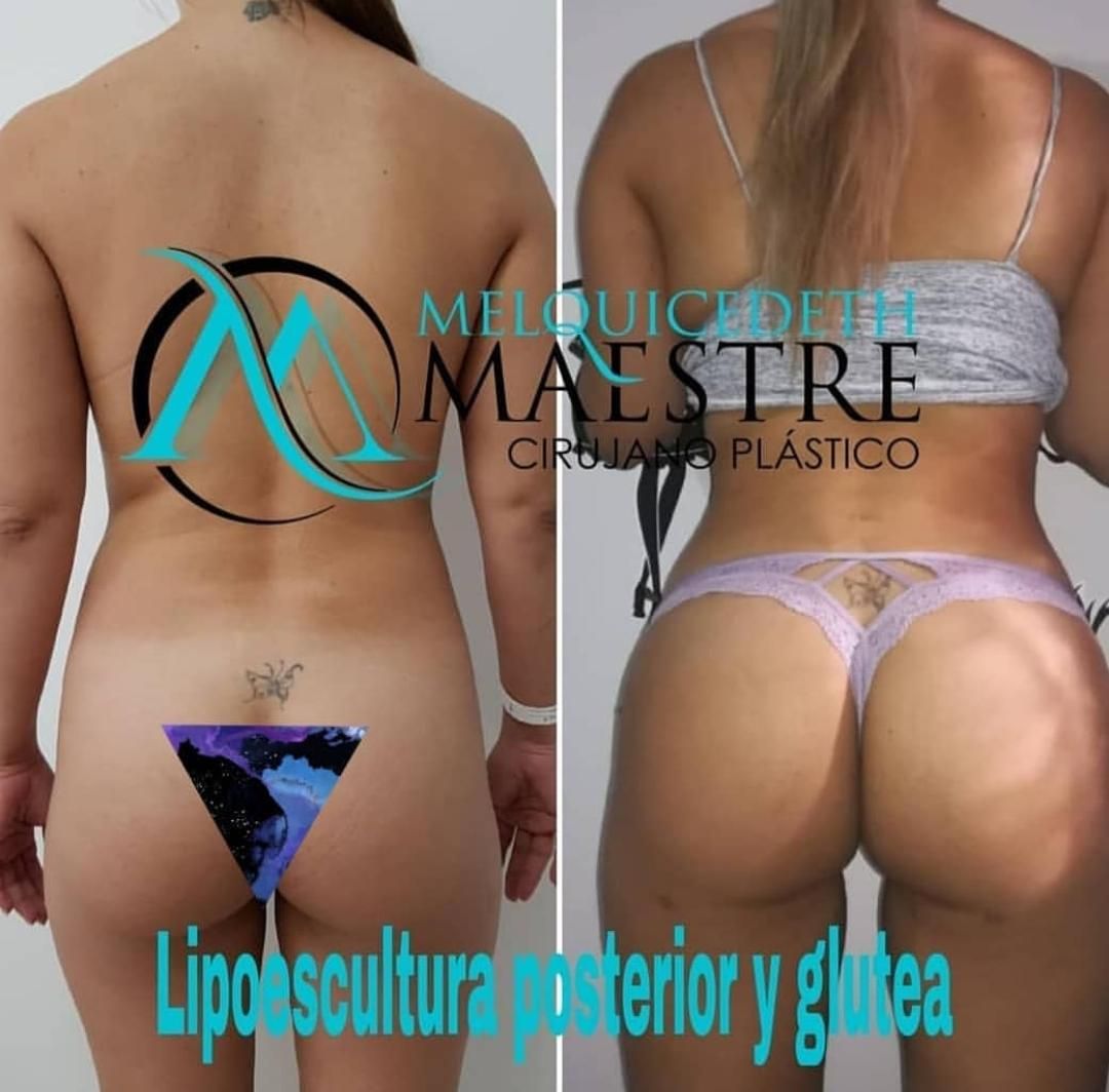 Melquicedeth Maestre-12