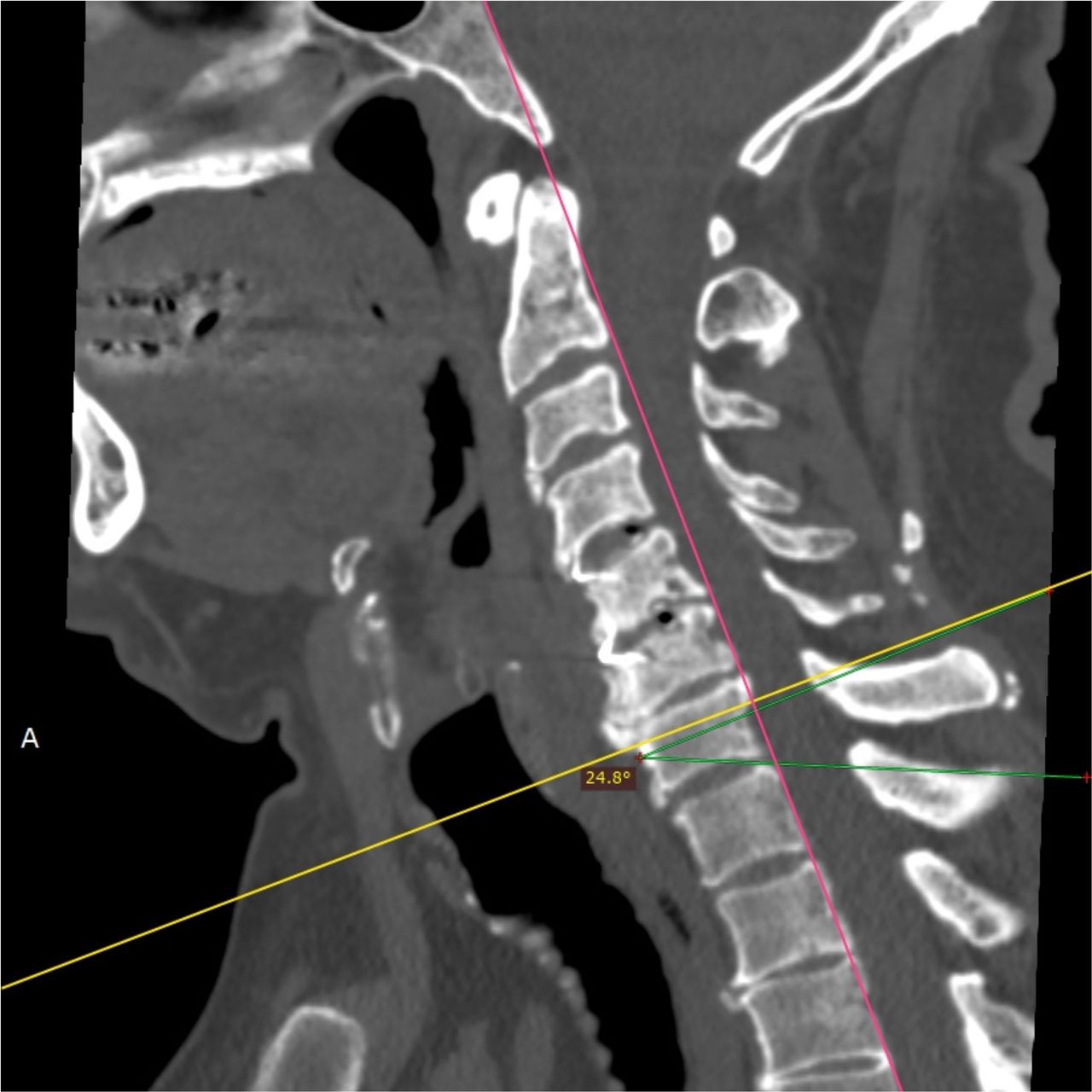 David Tafur Muñoz-1441