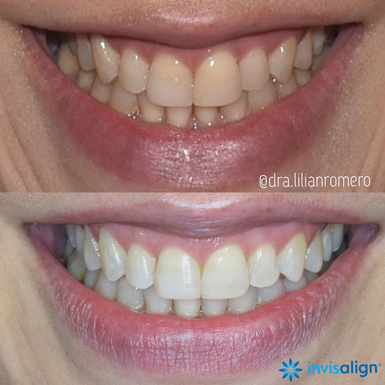 Lilian Catalina Romero Diaz-8