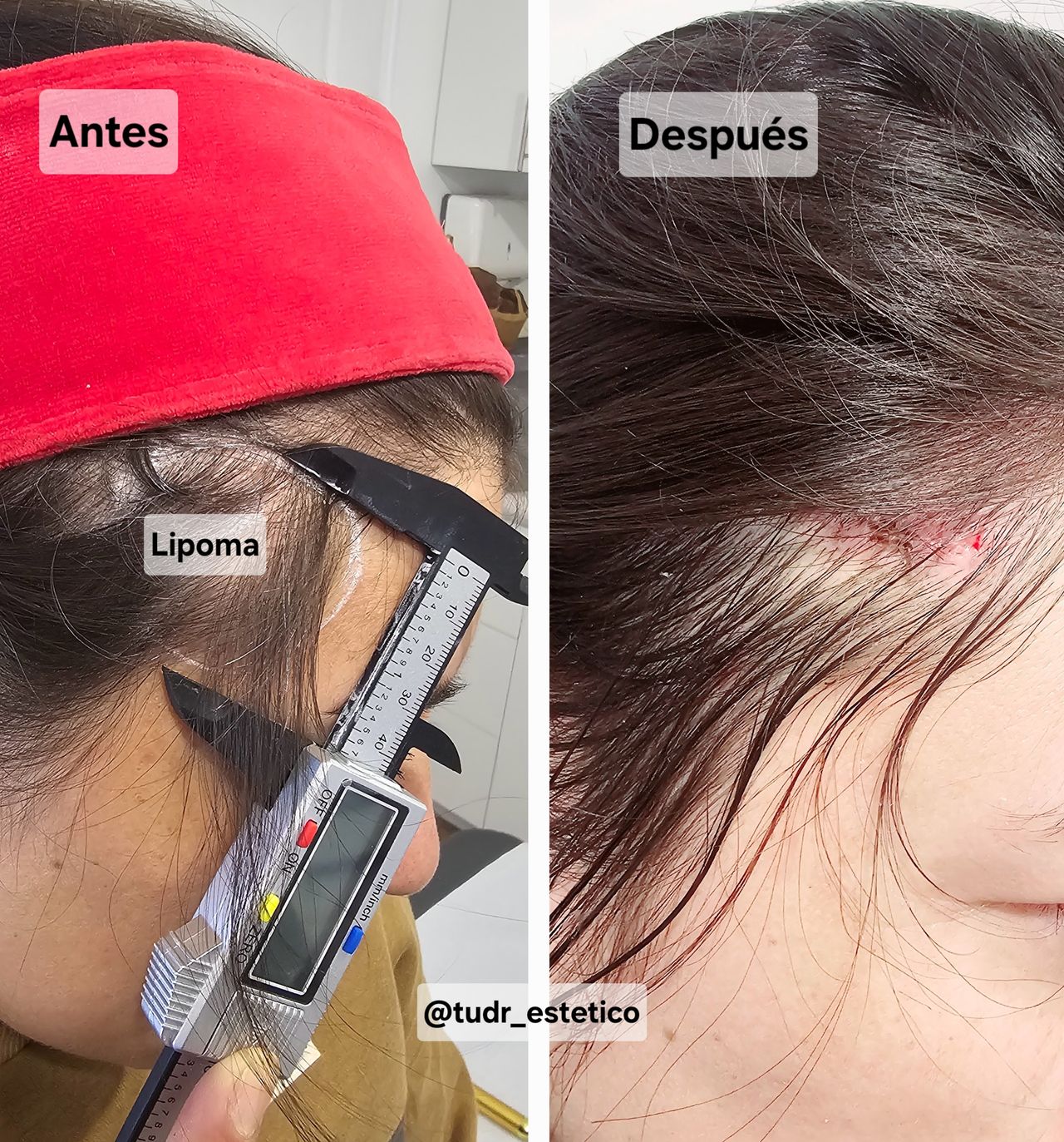 Diego Indriago Arias-15