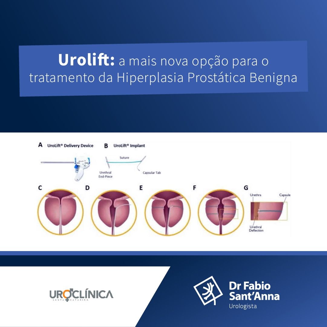 Fabio Sant Anna De Moraes-13