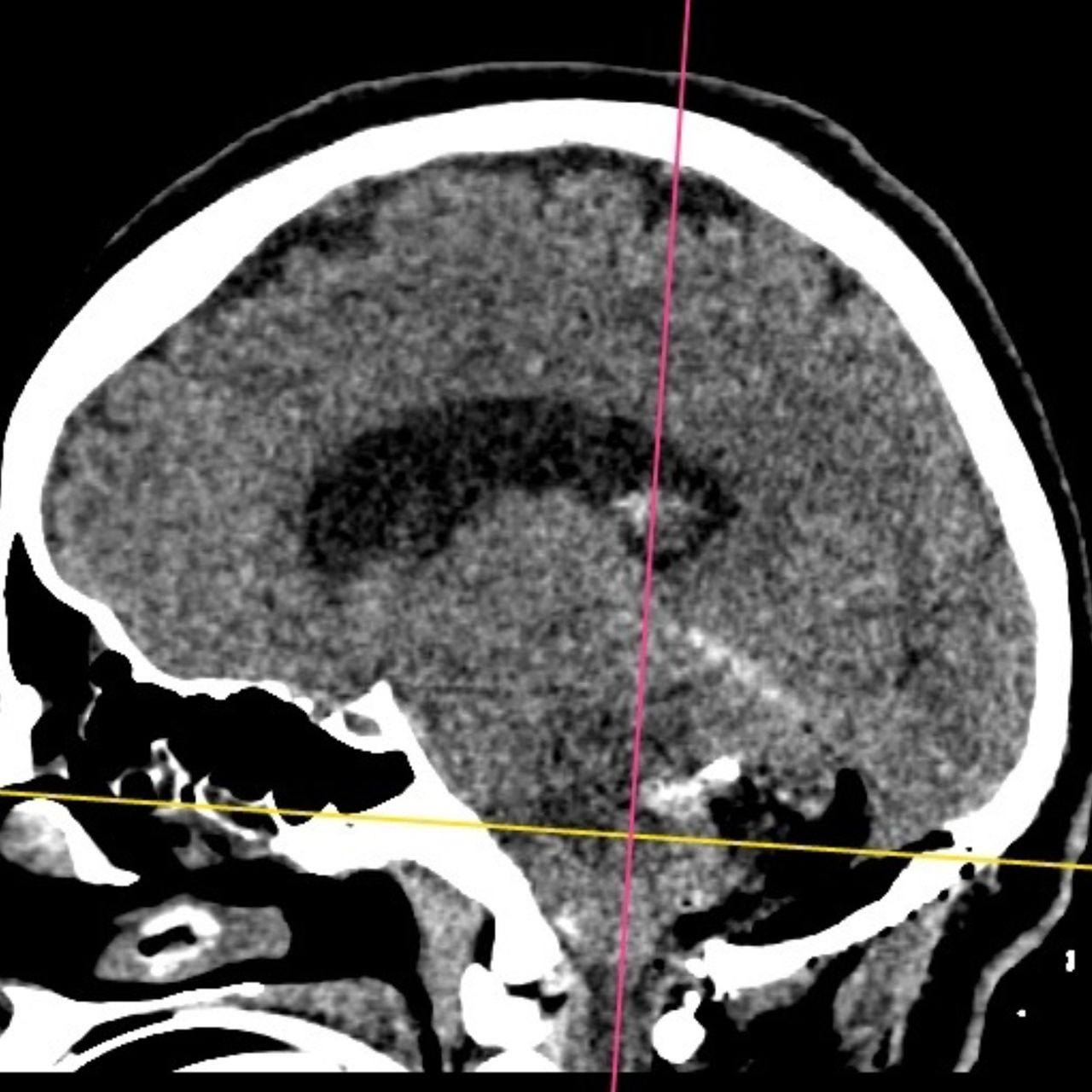 David Tafur Muñoz-1359