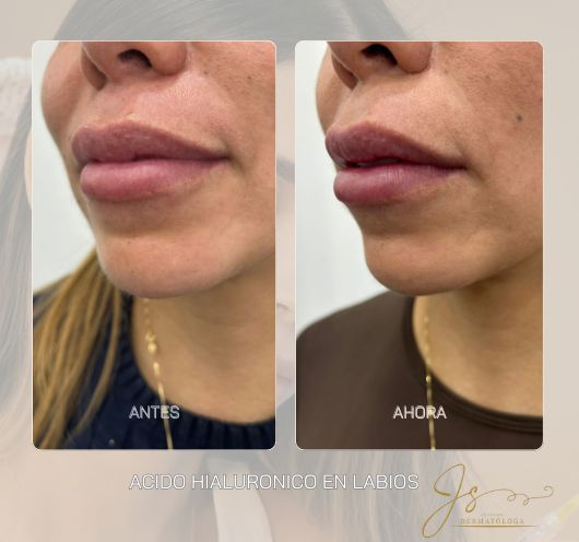 Jasiel Sarai Salas Gomez-4