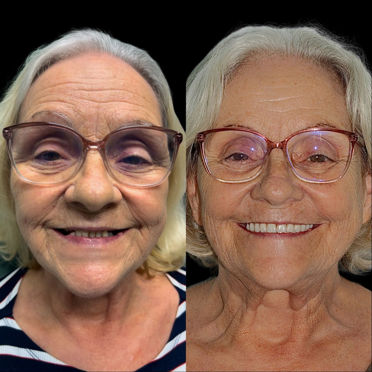 Caroline Benedeti-39