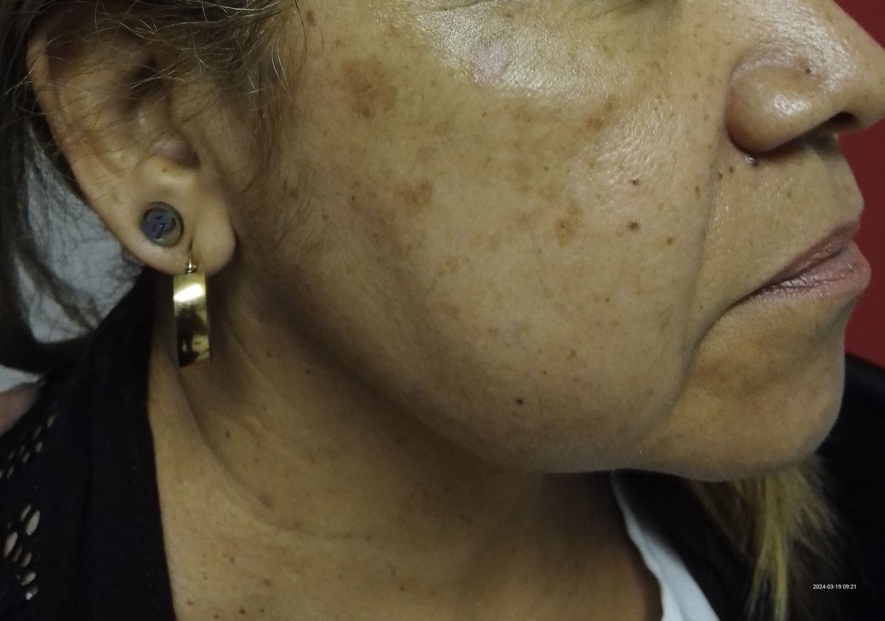 Alejandro Jose  Castellano Parra -0