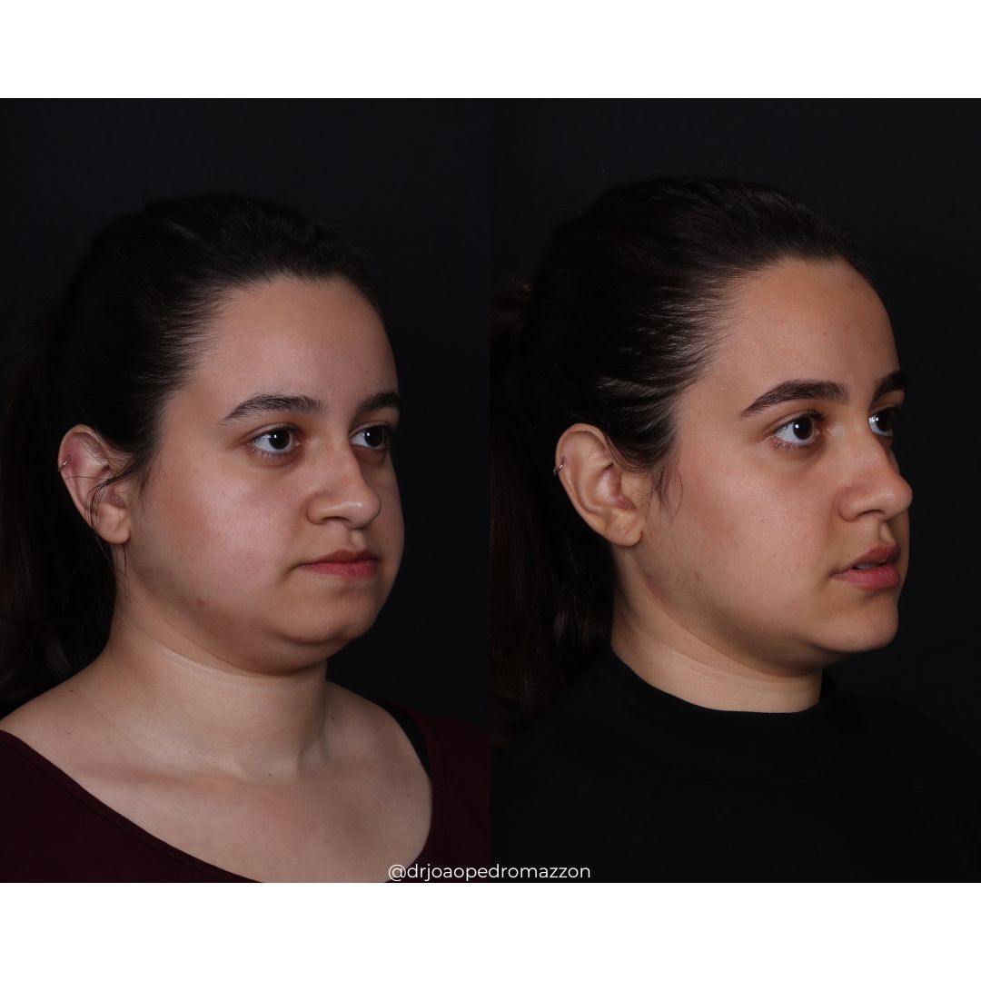 João Pedro Paulino Mazzon-63