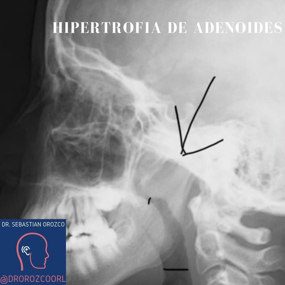 Sebastian Orozco Arteaga-3