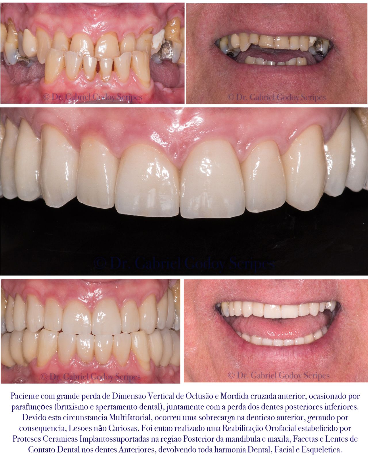 Gabriel Godoy Scripes-88