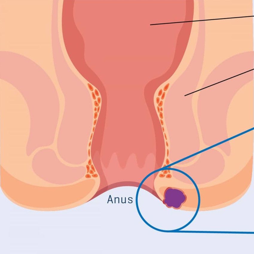Diogo Bicalho Silva-6