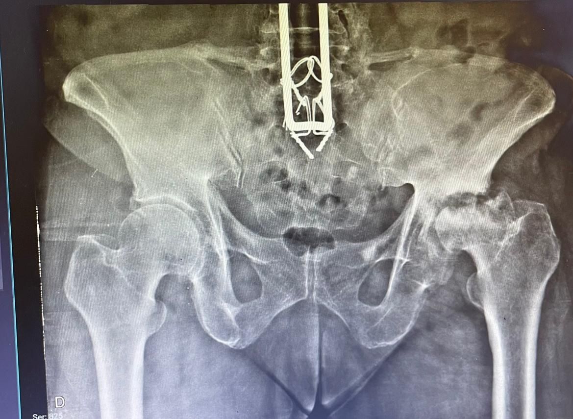 Jônatas Laurindo Giacomini-12