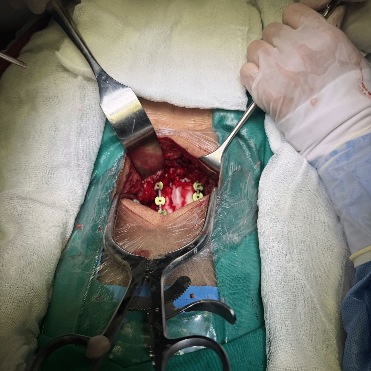 David Tafur Muñoz-2341