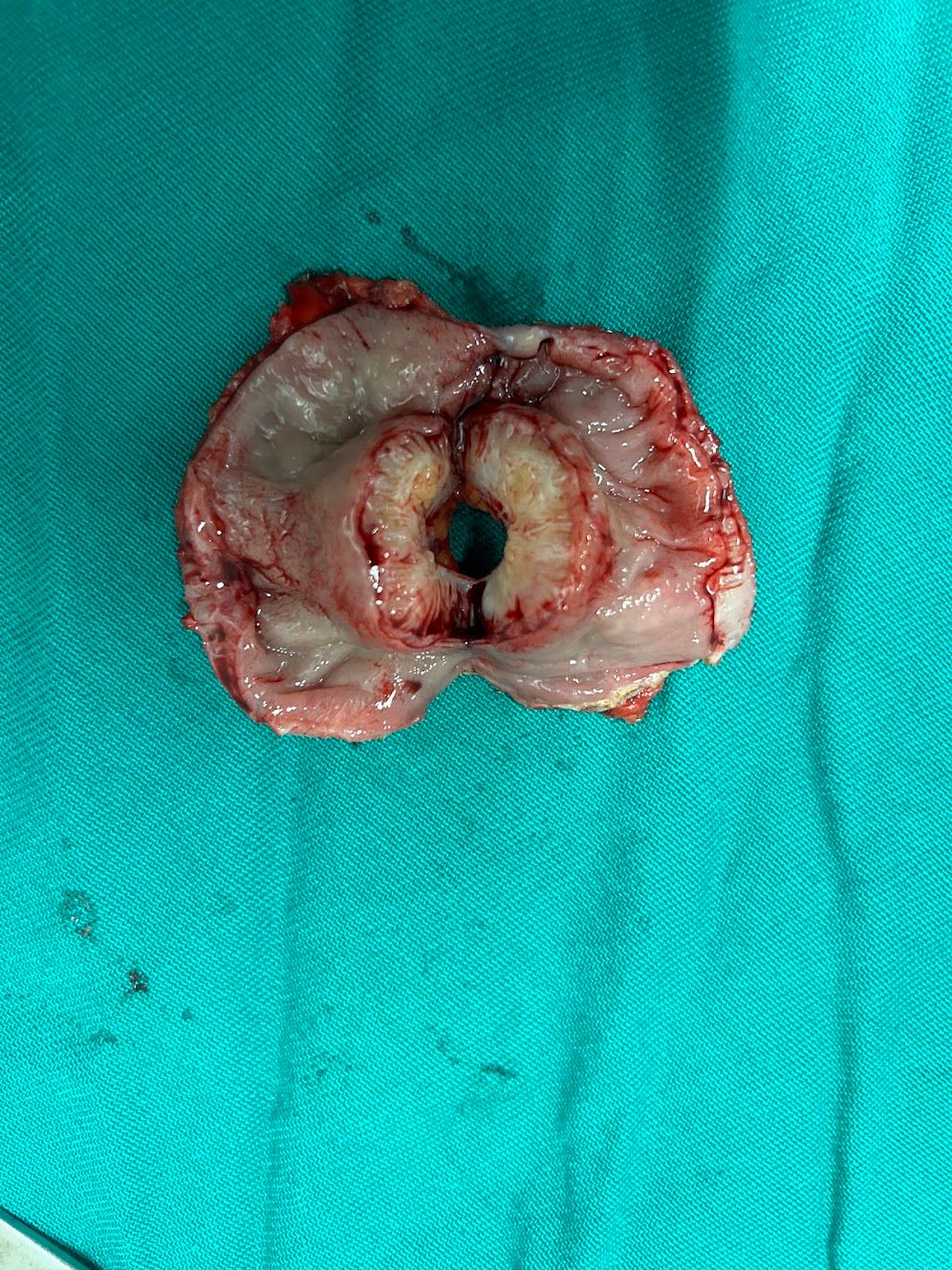 Adalberto Cesario Pereira Junior-62