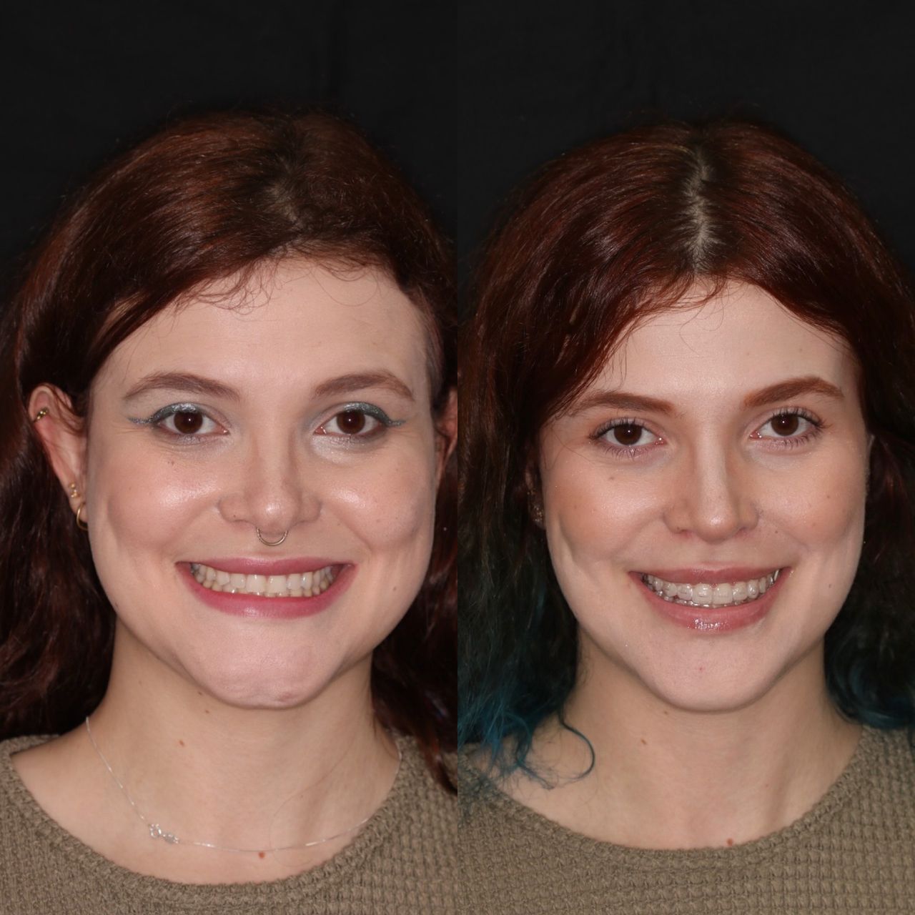 Bruno Nifossi Prado-21