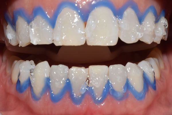 Gersa A. Domingues E Silva-4